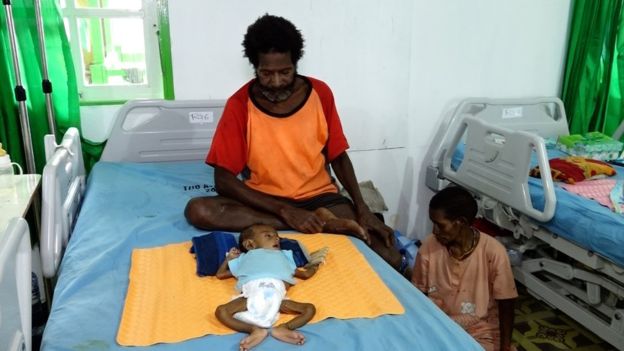 Indonesia's Papua province children starving in a land of gold